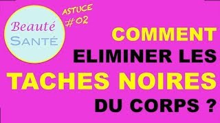 Astuces 02  Comment éliminer les taches noires du corps [upl. by June]