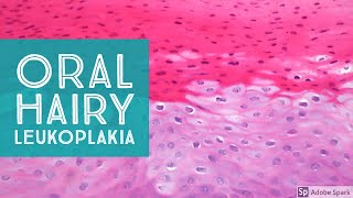 Oral Hairy LeukoplakiaExplained by a Dermatopathologist [upl. by Tiloine]