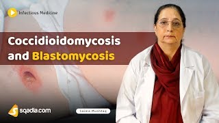 Coccidioidomycosis and Blastomycosis  Internal Medicine Infectious Disease  VLearning [upl. by Atineg]