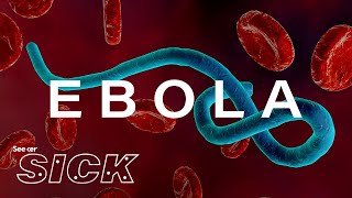 What Ebola Does to the Body [upl. by Piks]