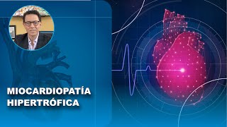 MIOCARDIOPATÍA HIPERTRÓFICA [upl. by Elitnahc]