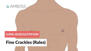 Fine Crackles Rales  Lung Auscultation  Episode 2 [upl. by Akamahs]