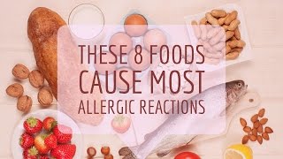 Food Allergy Causes Signs and Symptoms Diagnosis and Treatment [upl. by Cykana]