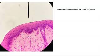 Epithelial Tissue Practice quiz [upl. by Navnod]