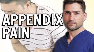 Appendicitis  How Do I Know If I Have Appendicitis [upl. by Alisun]