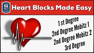 AV Heart Blocks Made Easy  1st 2nd 3rd Degree ECG Interpretation Explained [upl. by Tailor350]