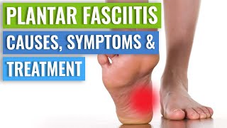 Plantar Fasciitis  Diagnosis And Treatment [upl. by Rolyt]