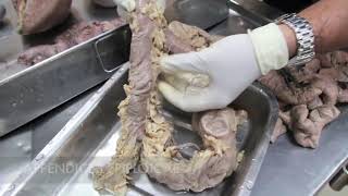 Anatomy Dissection of Large amp Small Intestine [upl. by Ydissak]