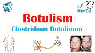 Botulism Clostridium Botulinum Pathogenesis Symptoms Diagnosis Treatment Prevention [upl. by Adiehsar]