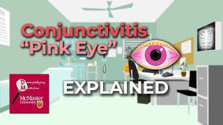 Conjunctivitis Pink Eye Explained [upl. by Manus]