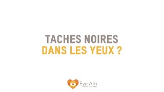 Apparition de taches noires dans les yeux [upl. by Nnylarej]