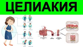 Глютен Целиакия  Ошибки Веганов [upl. by Ahcmis117]