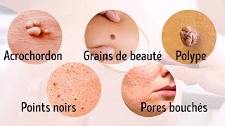 8 Maladies Graves Que Notre Peau Nous Signale [upl. by Eva]