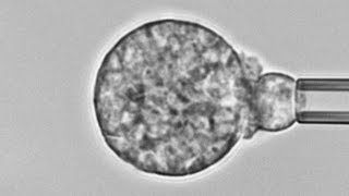 Human neutrophil versus Coccidioides cause of Valley fever Chemotaxis adhesion and phagocytosis [upl. by Thynne]