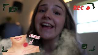 HICKEY PRANK ON BOYFRIEND He Freaked Out EMOTIONAL REACTION🔥💋 Piper Rockelle [upl. by Dominic]