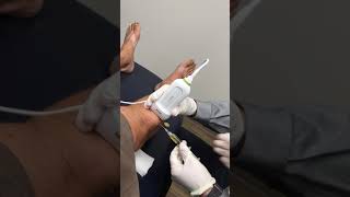 Prepatellar Bursa Aspiration  Elite Sports Medicine  Lethbridge [upl. by Thierry]