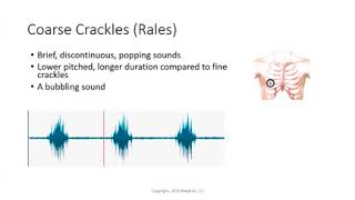 Coarse crackles Rales Lung Sounds [upl. by Adnilav]