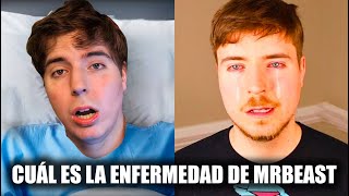 Cuál es LA ENFERMEDAD que tiene MRBEAST [upl. by Pippy]