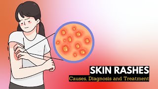 Skin Rash Causes Signs and Symptoms Diagnosis and Treatment [upl. by Mariam970]