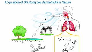 Dimorphic Fungi Blastomycosis Hot Topic [upl. by Juanne]