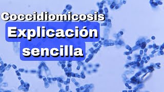 Coccidiomicosis fácil explicación [upl. by Airla]