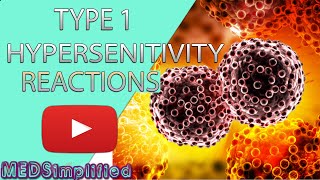 Type I hypersensitivity IgEmediated hypersensitivity  causes symptoms pathology [upl. by Selrahc355]