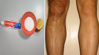 How To Remove Leg Hair Permanently [upl. by Westbrook46]