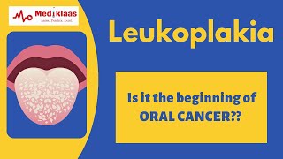 Leukoplakia l Precancerous lesions l Oral pathology l Mediklaas [upl. by Hardigg427]